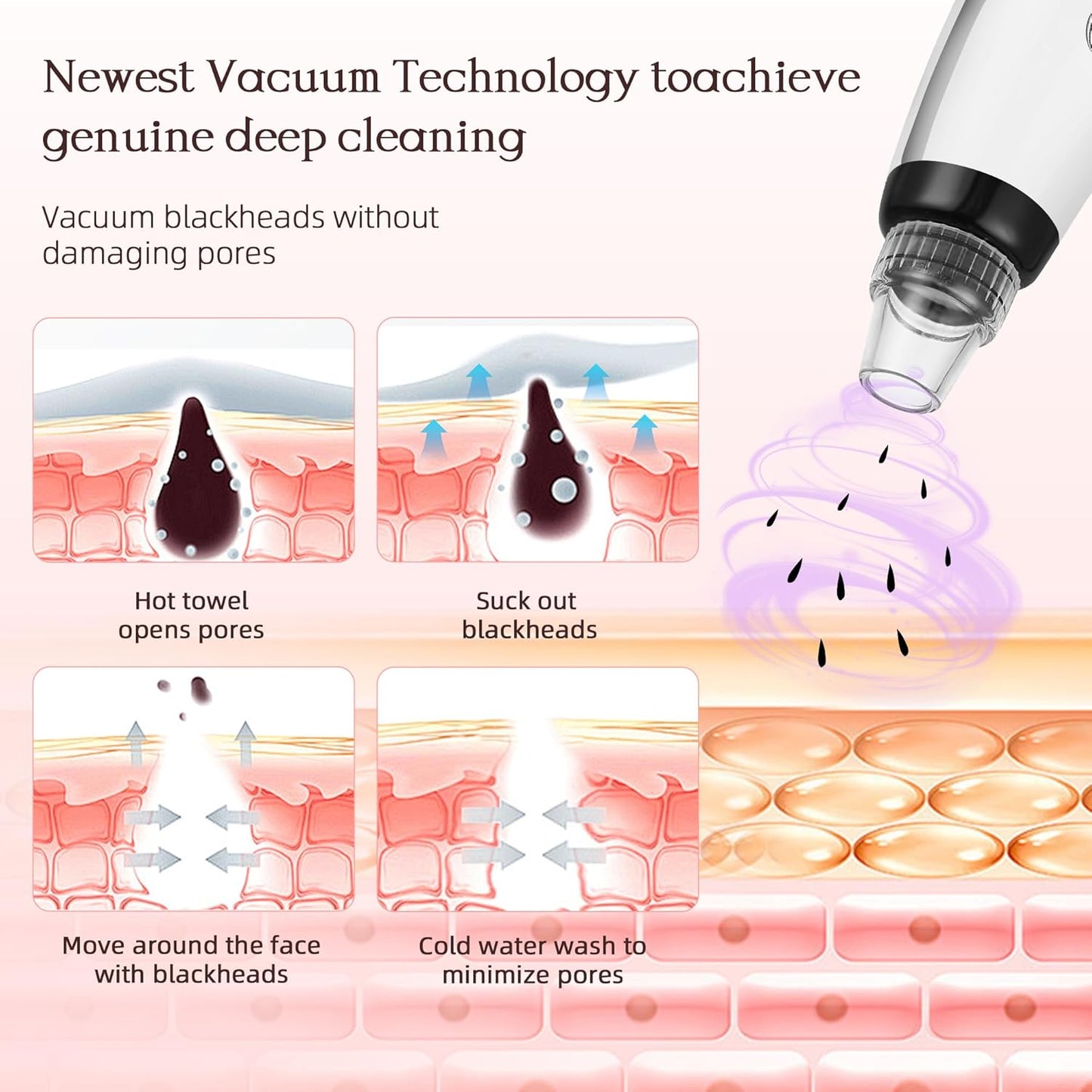 5-in-1 Blackhead & Acne Remover Vacuum