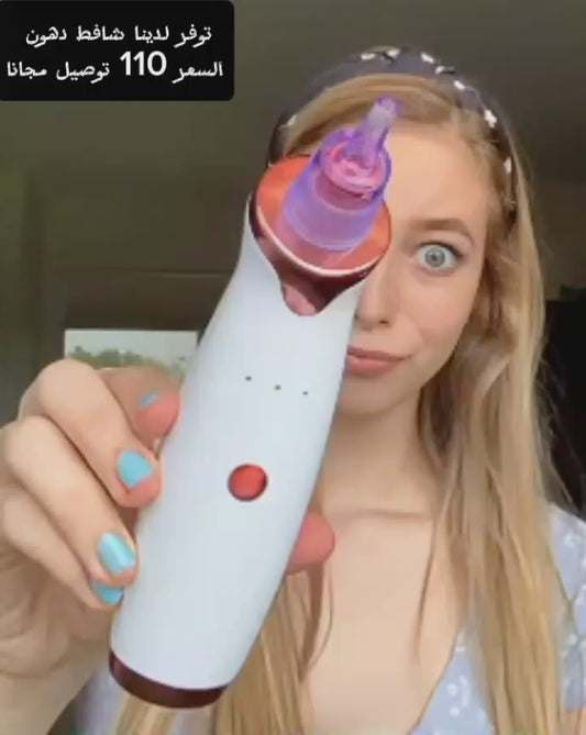 5-in-1 Blackhead & Acne Remover Vacuum