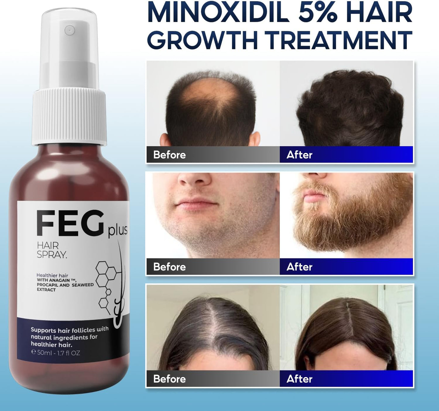 FEGPLUS Minoxidil Hair & Beard Growth Serum (50ml)